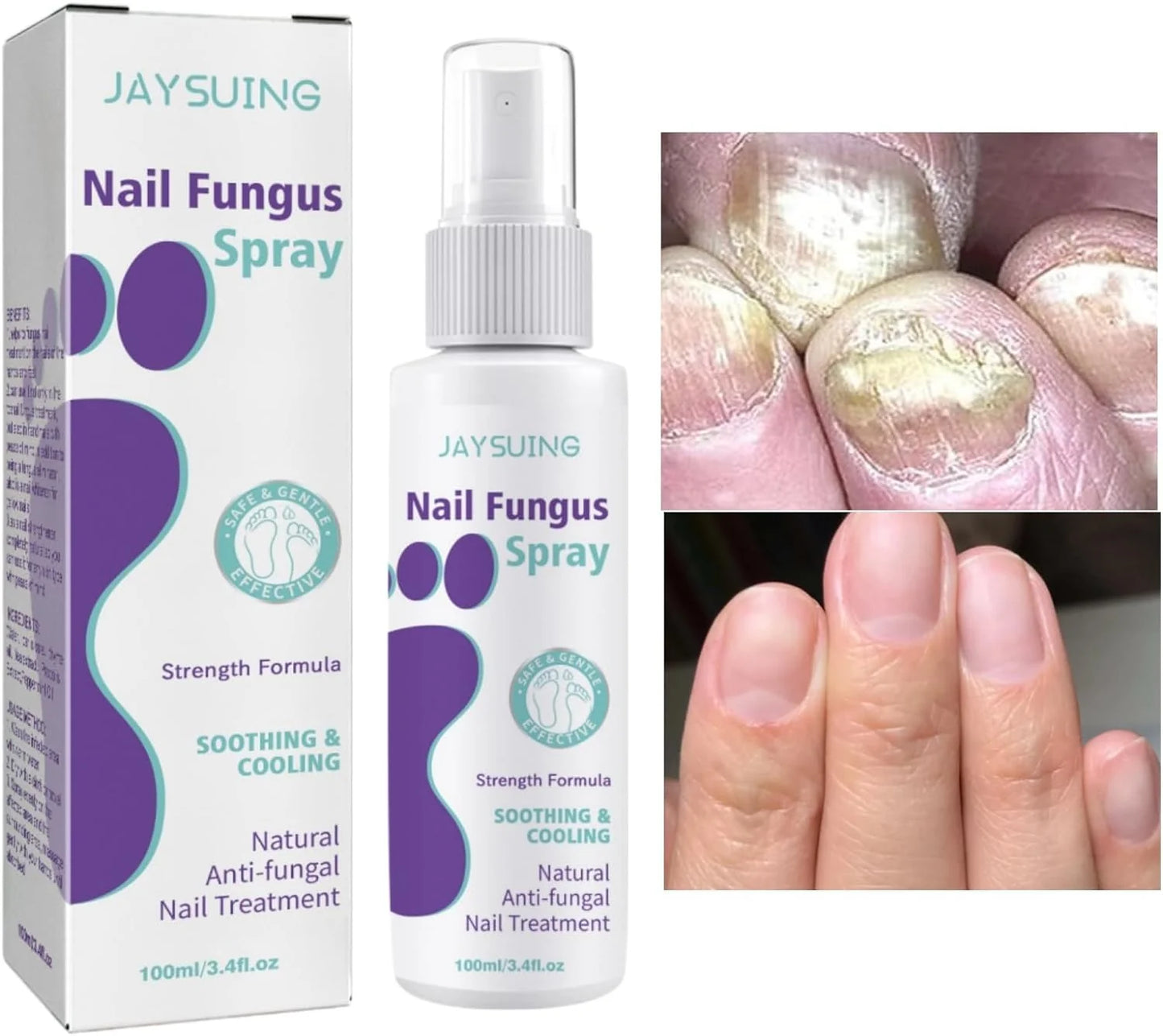Nail Repair Spray