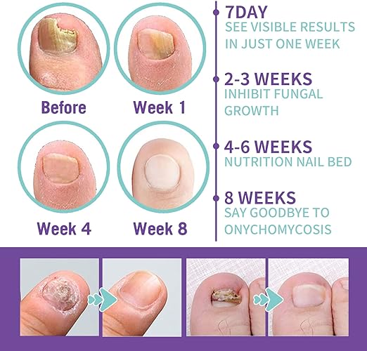 Nail Repair Spray