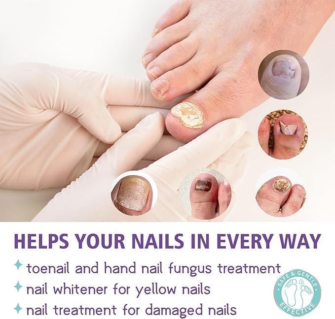 Nail Repair Spray