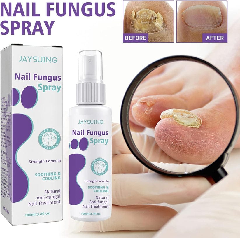 Nail Repair Spray
