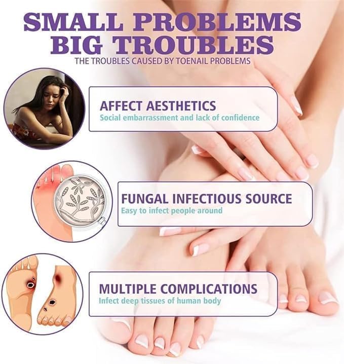 Nail Repair Spray